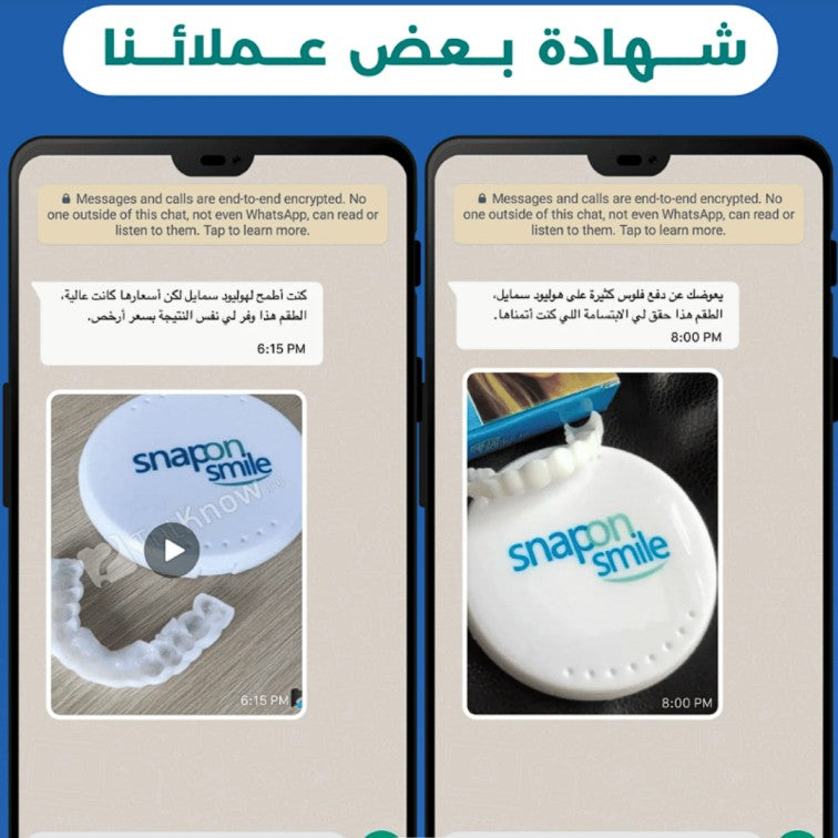 😁✨ Snap-On Smile® – ابتسامة مثالية في ثوانٍ