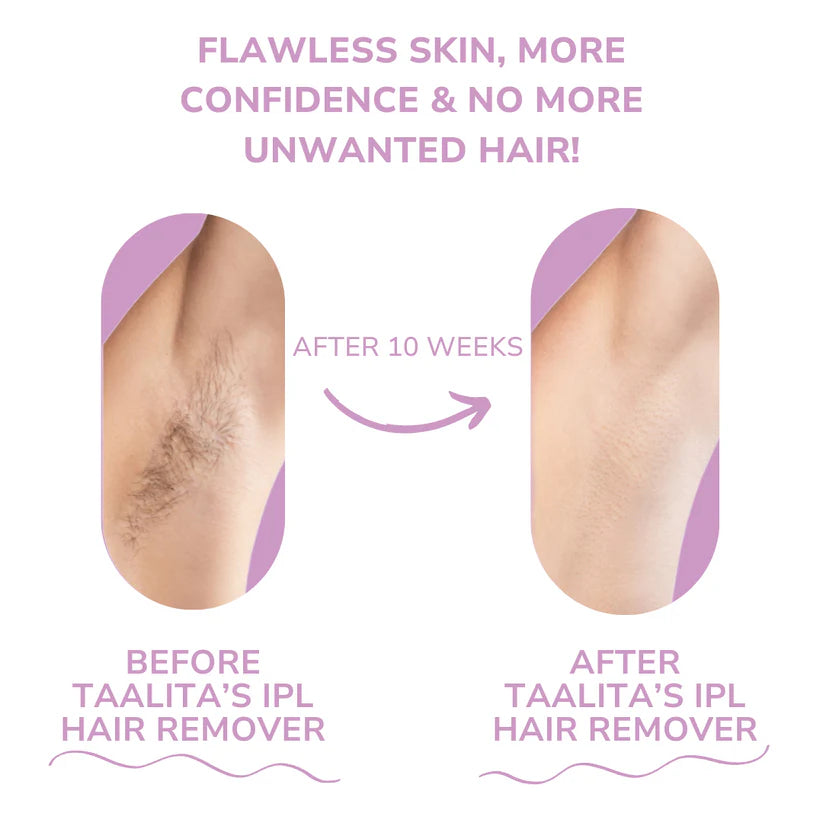 𝐁𝐞𝐚𝐮𝐭𝐲𝐏𝐥𝐮𝐬 𝐈𝐏𝐋 𝐇𝐚𝐢𝐫 𝐑𝐞𝐦𝐨𝐯𝐞𝐫 I The Leading Laser Hair Removal