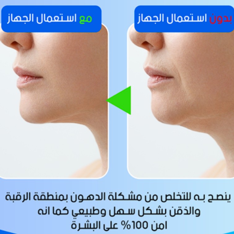 تنعيم ونحت البشرة، شد البشرة، إزالة التجاعيد والذقن المزدوجة